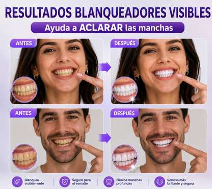 Blanqueador Dental en Polvo Medcodes